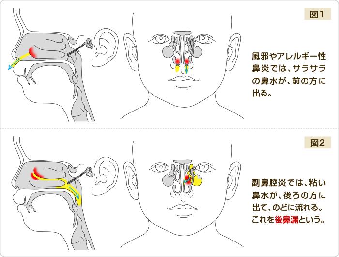 鼻水 後ろ に 流れる